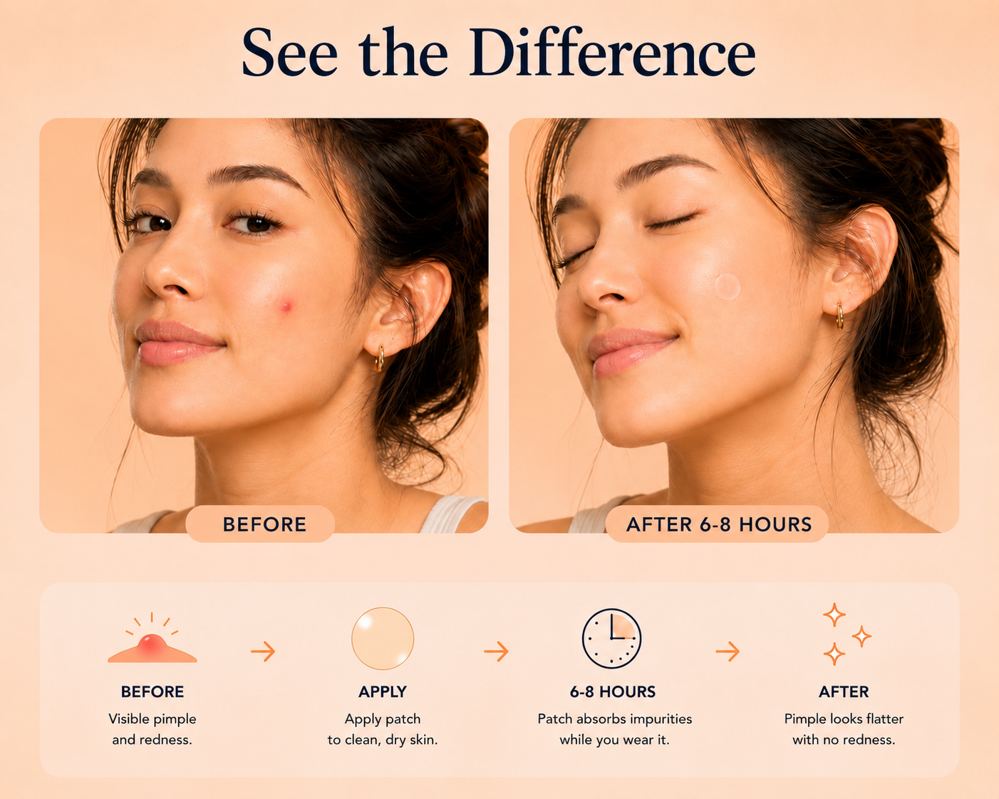 Rapid Patch | 36 Invisible Hydrocolloid Pimple Patches