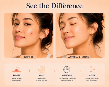 Rapid Patch | 36 Invisible Hydrocolloid Pimple Patches